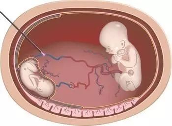 传输失败 产品主图