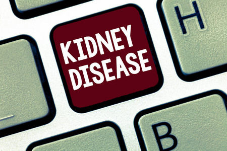 叠影惊情 相关产品